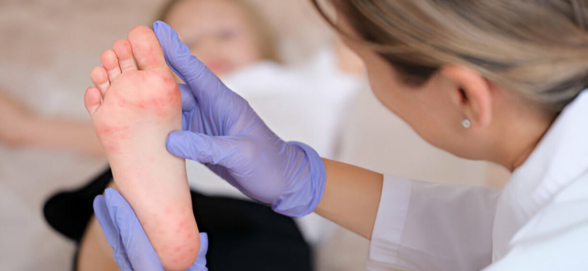 Common Children's Foot Problems